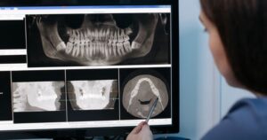 CADCAM en odontología