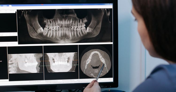 CADCAM en odontología