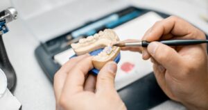 madrid laboratorio dental