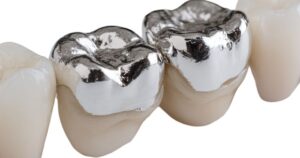 materiales prótesis dentales